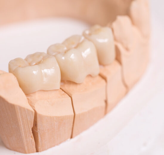 The Cost and Benefits of Fixed Bridge Dental Service in Manila Philippines