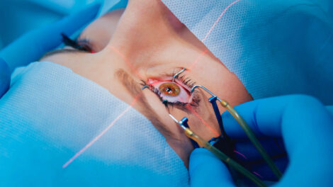 Cataract Surgery What You Need to Know Before You Decide