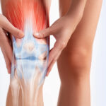 StemCellCures FDA Approved Non Surgical Stem Cell Solution for Early Stage Knee Osteoarthritis