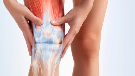 StemCellCures FDA Approved Non Surgical Stem Cell Solution for Early Stage Knee Osteoarthritis
