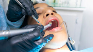 Expert Dental Services Near Washington DC