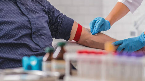 The Ultimate Guide to Diabetes Screening in the Philippines What Every Filipino Needs to Know